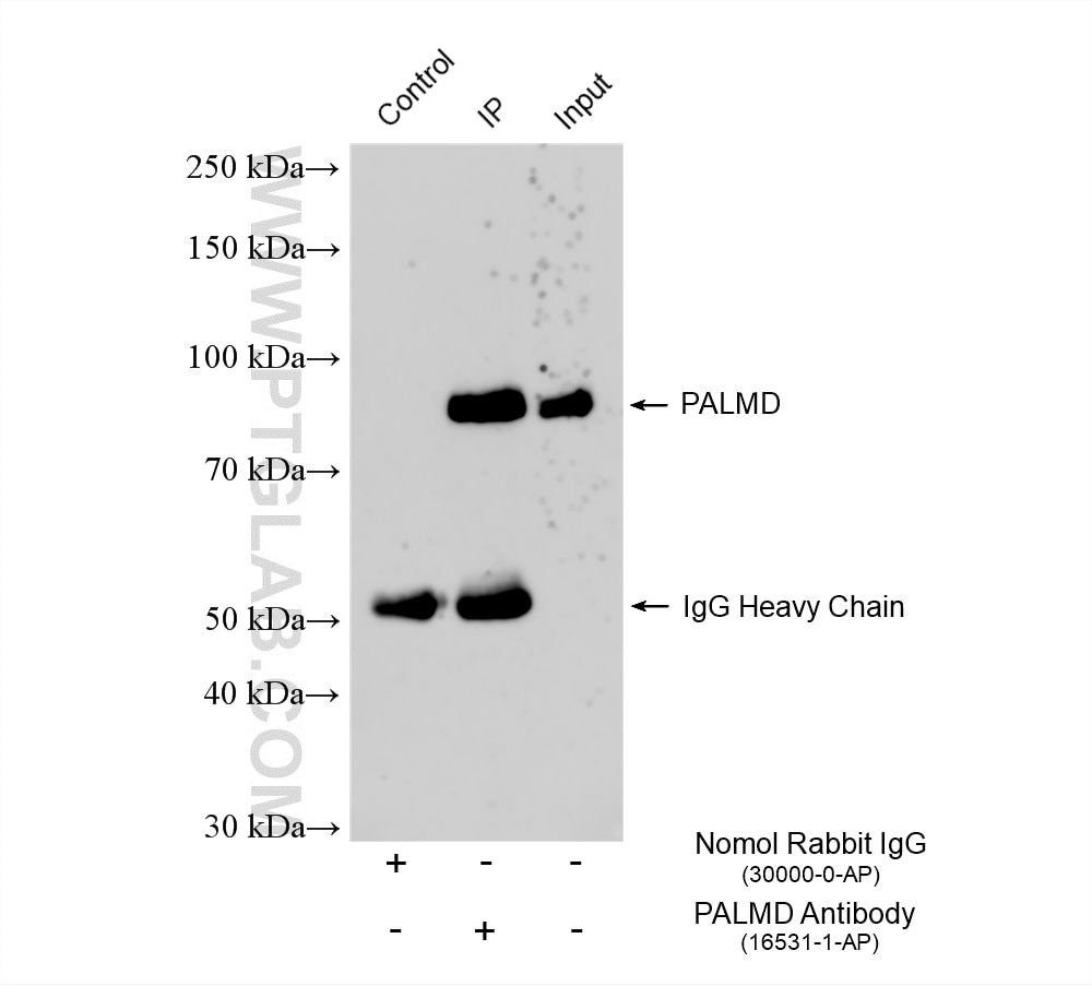 Immunoprecipitation (IP) experiment of HeLa cells using PALMD Polyclonal antibody (16531-1-AP)