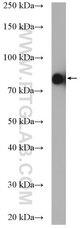 Western Blot (WB) analysis of HeLa cells using PALMD Polyclonal antibody (16531-1-AP)