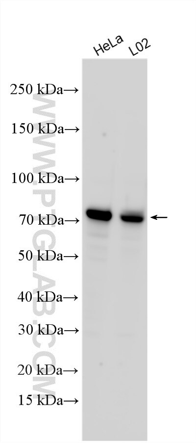 Western Blot (WB) analysis of various lysates using PALMD Polyclonal antibody (16531-1-AP)