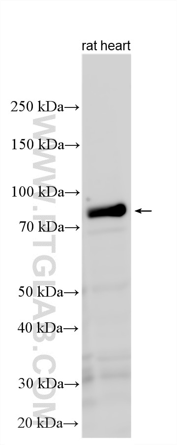 Western Blot (WB) analysis of various lysates using PALMD Polyclonal antibody (16531-1-AP)