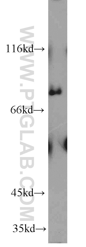 Western Blot (WB) analysis of HeLa cells using PALMD Polyclonal antibody (16531-1-AP)