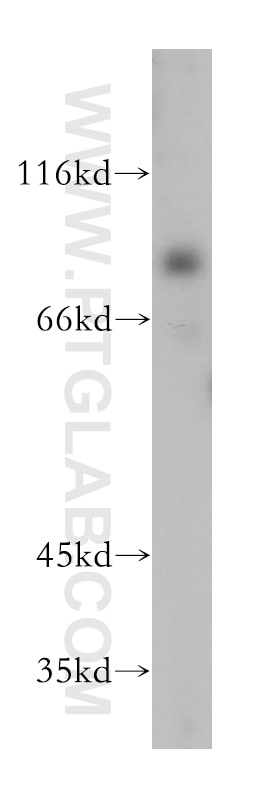 Western Blot (WB) analysis of mouse lung tissue using PALMD Polyclonal antibody (16531-1-AP)