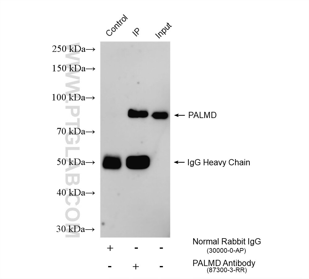 IP result of anti-PALMD (IP:87300-3-RR, 4ug; Detection:87300-3-RR 1:2000) with HeLa cells lysate 1320 ug. Immunoprecipitation (IP) experiment of HeLa cells using PALMD Recombinant monoclonal antibody (87300-3-RR)