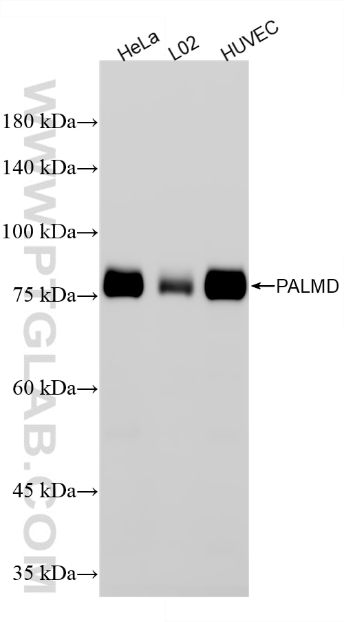 Various lysates were subjected to SDS PAGE followed by western blot with 87300-3-RR (PALMD antibody) at dilution of 1:10000 incubated at room temperature for 1.5 hours. Western Blot (WB) analysis of various lysates using PALMD Recombinant monoclonal antibody (87300-3-RR)