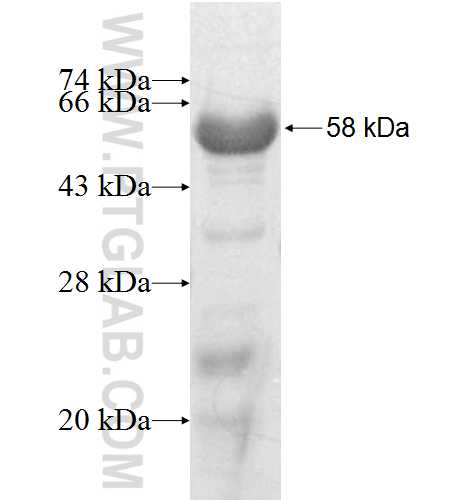PALMD fusion protein Ag9796 SDS-PAGE