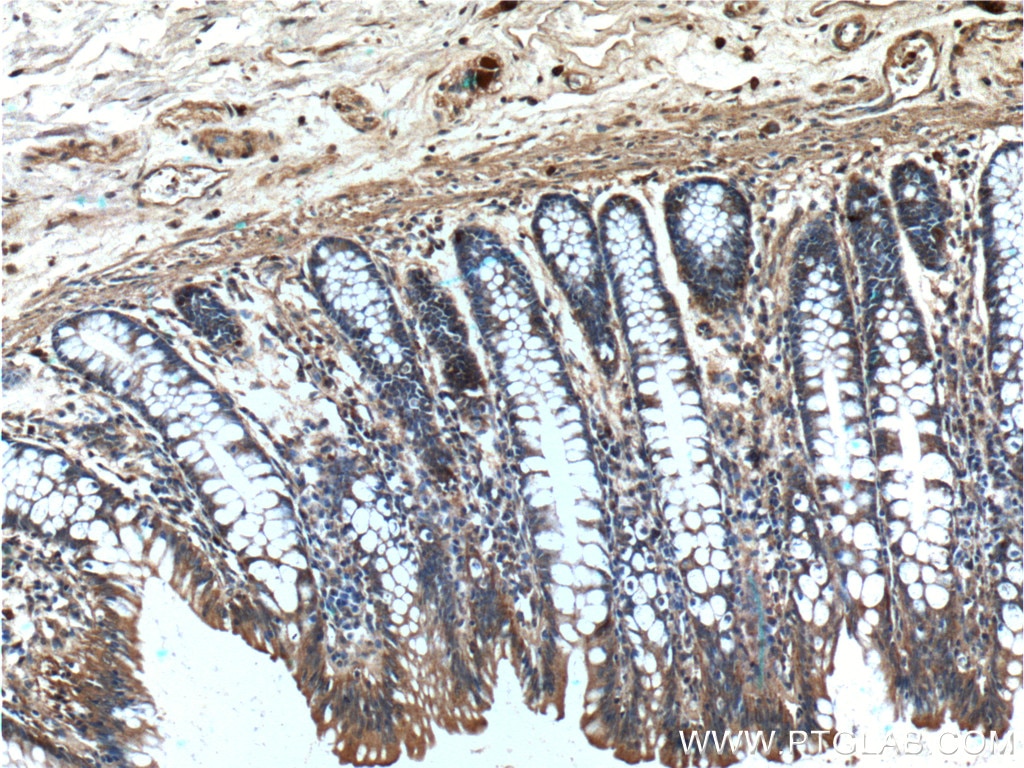 Immunohistochemistry (IHC) staining of human colon tissue using PAM Polyclonal antibody (26972-1-AP)
