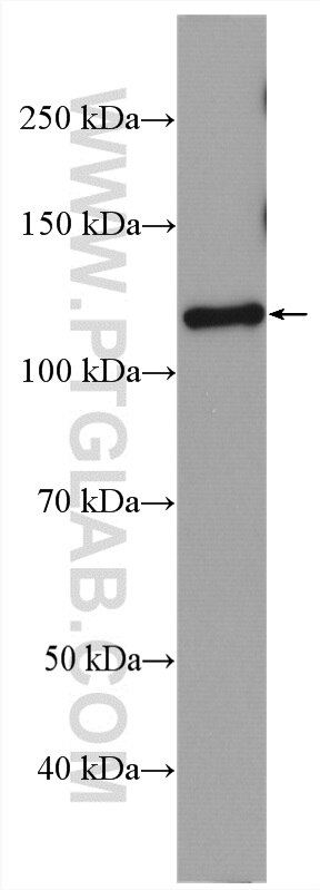 Western Blot (WB) analysis of U2OS cells using PAM Polyclonal antibody (26972-1-AP)