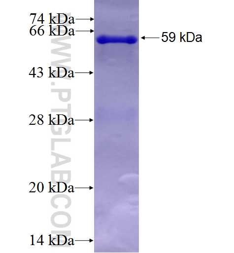 PAM fusion protein Ag25719 SDS-PAGE