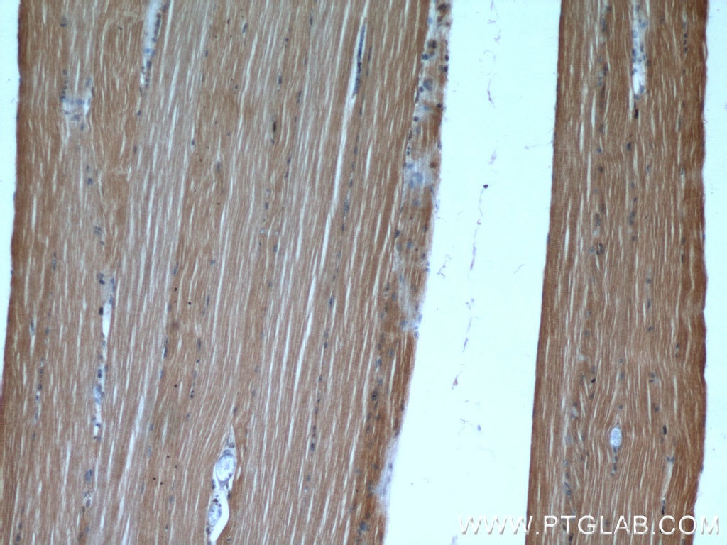 Immunohistochemistry (IHC) staining of human skeletal muscle tissue using PAMR1 Polyclonal antibody (55310-1-AP)