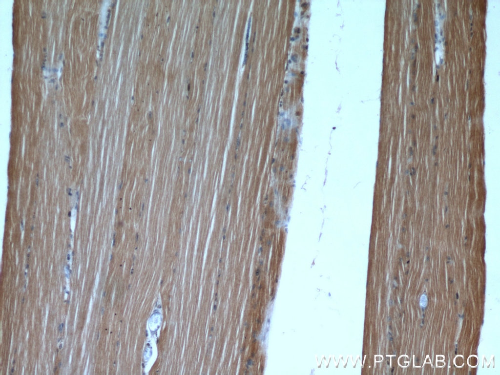 Immunohistochemistry (IHC) staining of human skeletal muscle tissue using PAMR1 Polyclonal antibody (55310-1-AP)