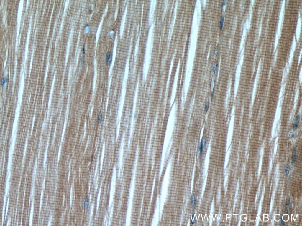 Immunohistochemistry (IHC) staining of human skeletal muscle tissue using PAMR1 Polyclonal antibody (55310-1-AP)