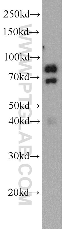 Western Blot (WB) analysis of mouse skeletal muscle tissue using PAMR1 Polyclonal antibody (55310-1-AP)