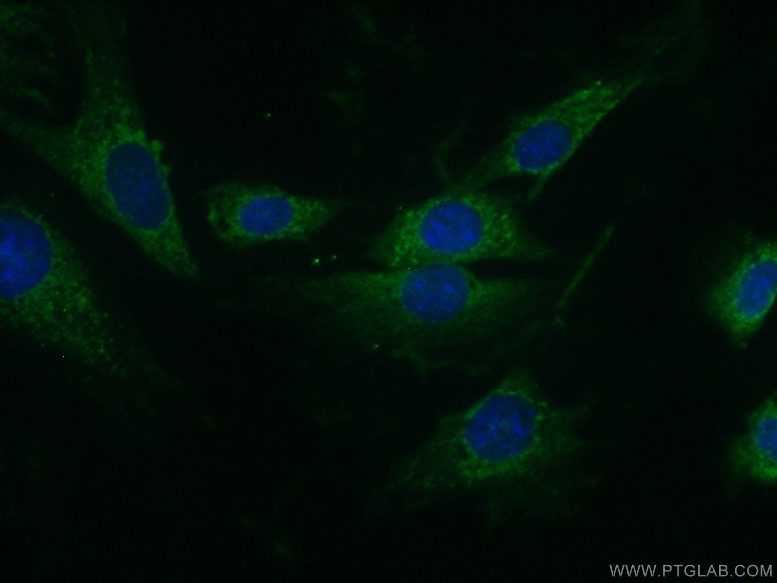 Immunofluorescence (IF) / fluorescent staining of NIH/3T3 cells using PAN2 Polyclonal antibody (16427-1-AP)