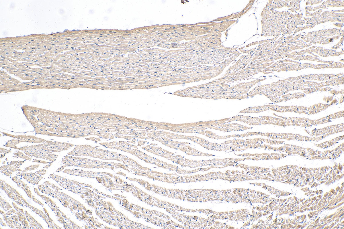 Immunohistochemistry (IHC) staining of mouse heart tissue using PAN2 Polyclonal antibody (16427-1-AP)