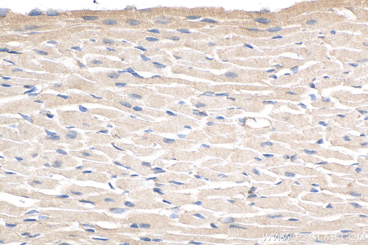 Immunohistochemistry (IHC) staining of mouse heart tissue using PAN2 Polyclonal antibody (16427-1-AP)