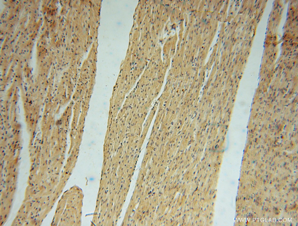 Immunohistochemistry (IHC) staining of human heart tissue using PAN2 Polyclonal antibody (16427-1-AP)