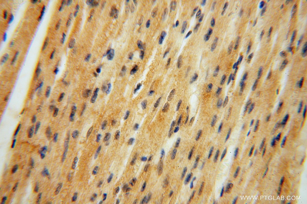 Immunohistochemistry (IHC) staining of human heart tissue using PAN2 Polyclonal antibody (16427-1-AP)