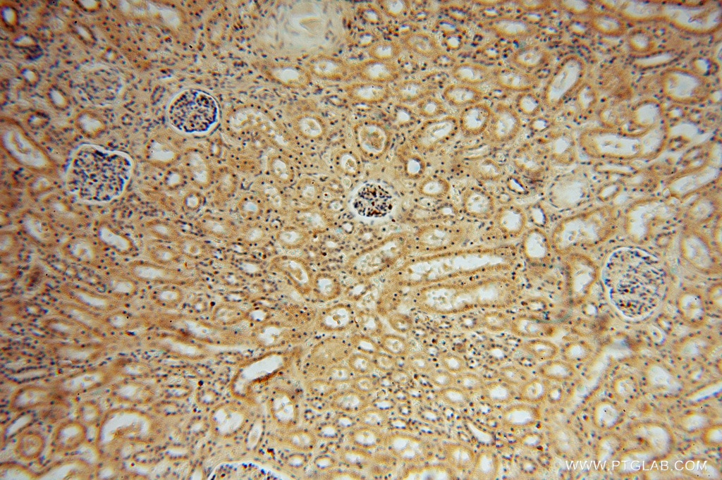 Immunohistochemistry (IHC) staining of human kidney tissue using PAN2 Polyclonal antibody (16427-1-AP)