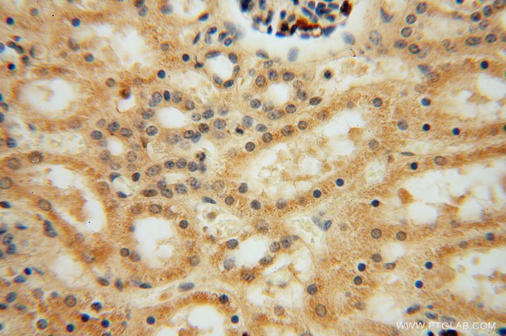 Immunohistochemistry (IHC) staining of human kidney tissue using PAN2 Polyclonal antibody (16427-1-AP)