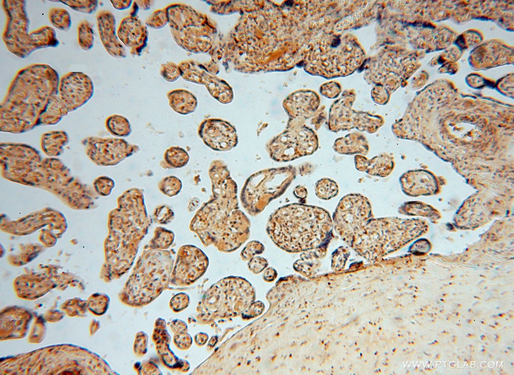 Immunohistochemistry (IHC) staining of human placenta tissue using PAN2 Polyclonal antibody (16427-1-AP)