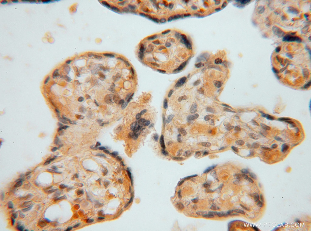 Immunohistochemistry (IHC) staining of human placenta tissue using PAN2 Polyclonal antibody (16427-1-AP)