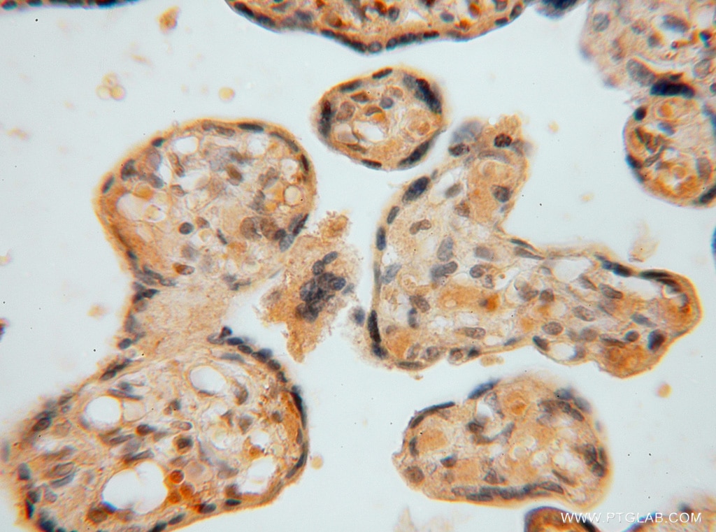 IHC staining of human placenta using 16427-1-AP