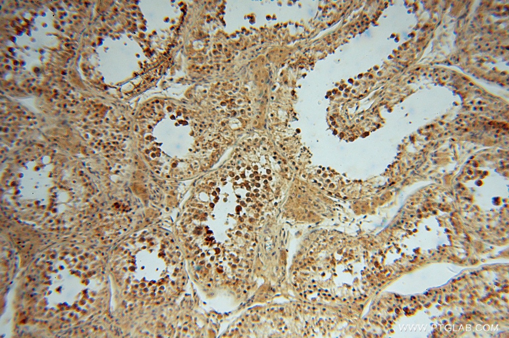 Immunohistochemistry (IHC) staining of human testis tissue using PAN2 Polyclonal antibody (16427-1-AP)