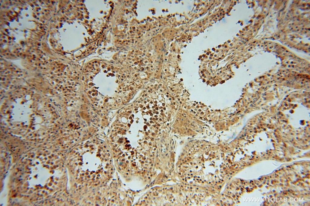 IHC staining of human testis using 16427-1-AP