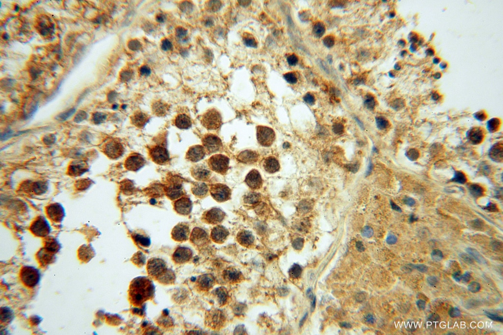 Immunohistochemistry (IHC) staining of human testis tissue using PAN2 Polyclonal antibody (16427-1-AP)