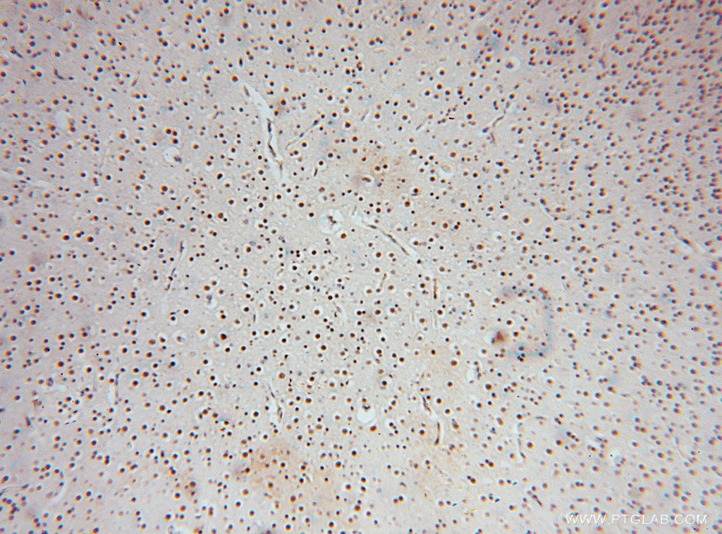 Immunohistochemistry (IHC) staining of human brain tissue using PAN2 Polyclonal antibody (16427-1-AP)