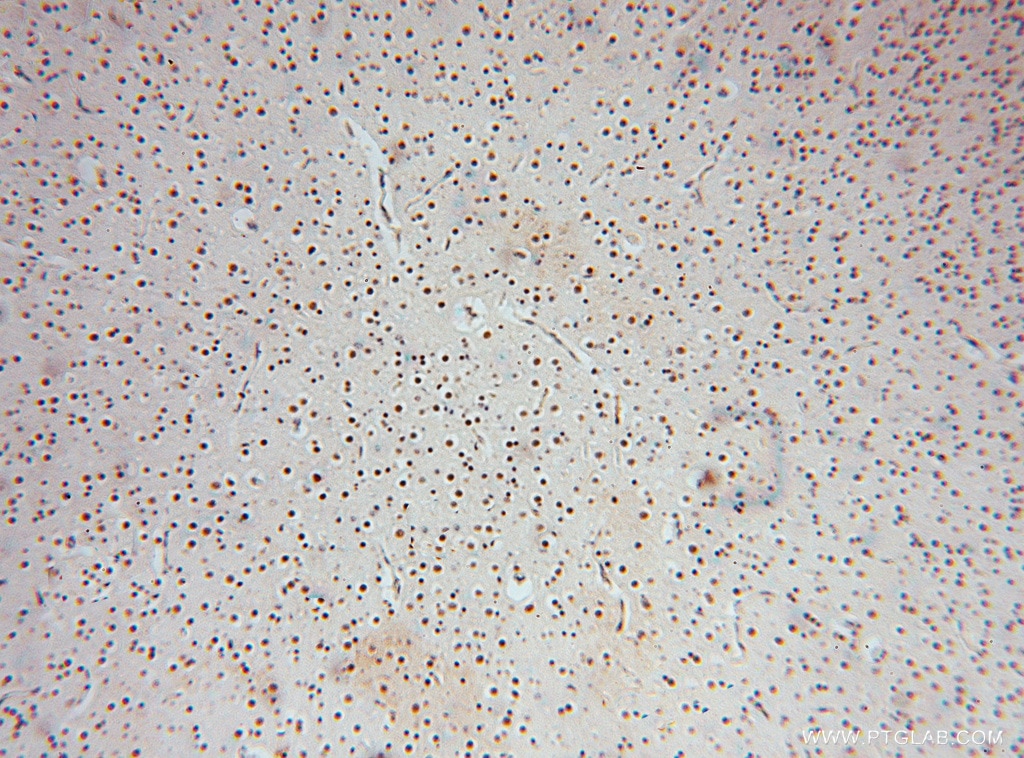 IHC staining of human brain using 16427-1-AP