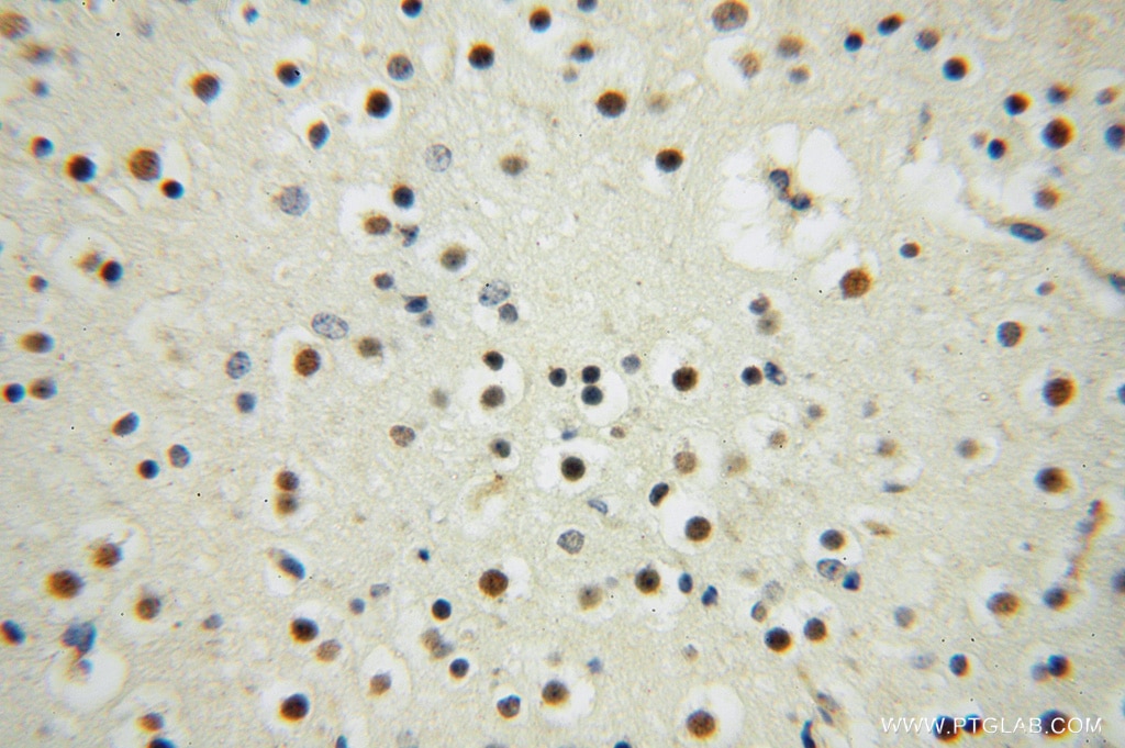 Immunohistochemistry (IHC) staining of human brain tissue using PAN2 Polyclonal antibody (16427-1-AP)