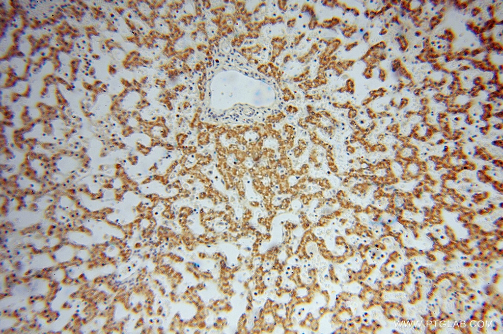 Immunohistochemistry (IHC) staining of human liver tissue using PAN2 Polyclonal antibody (16427-1-AP)