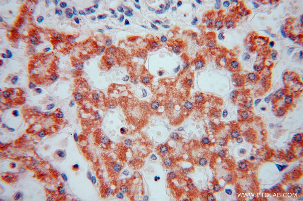 Immunohistochemistry (IHC) staining of human liver tissue using PAN2 Polyclonal antibody (16427-1-AP)