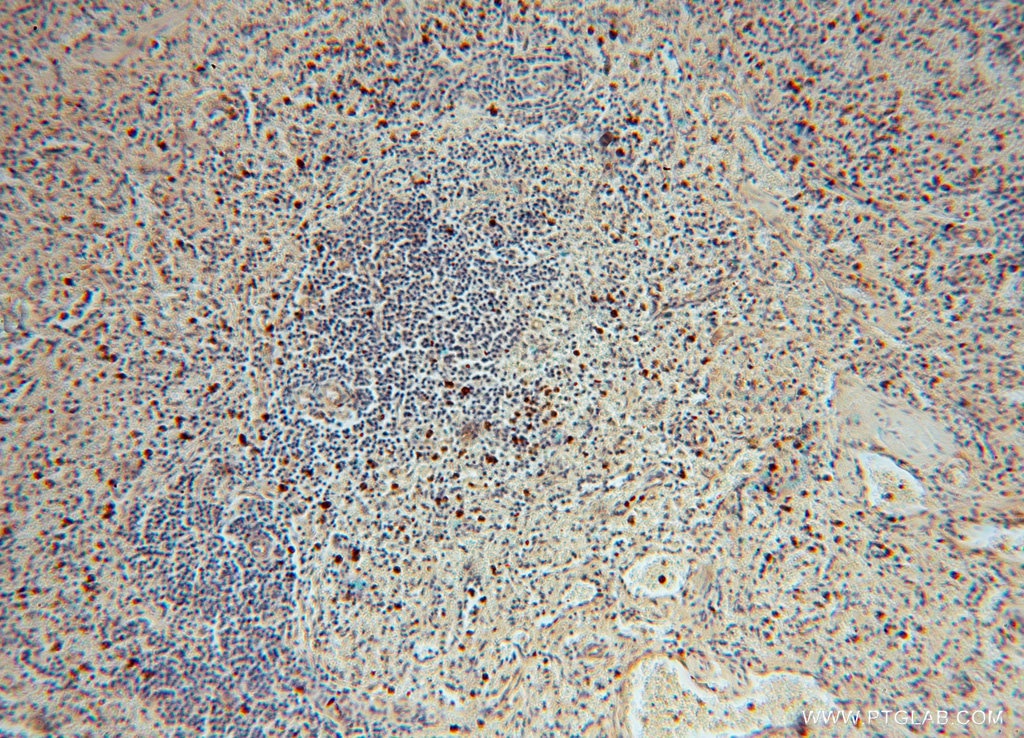 Immunohistochemistry (IHC) staining of human spleen tissue using PAN2 Polyclonal antibody (16427-1-AP)