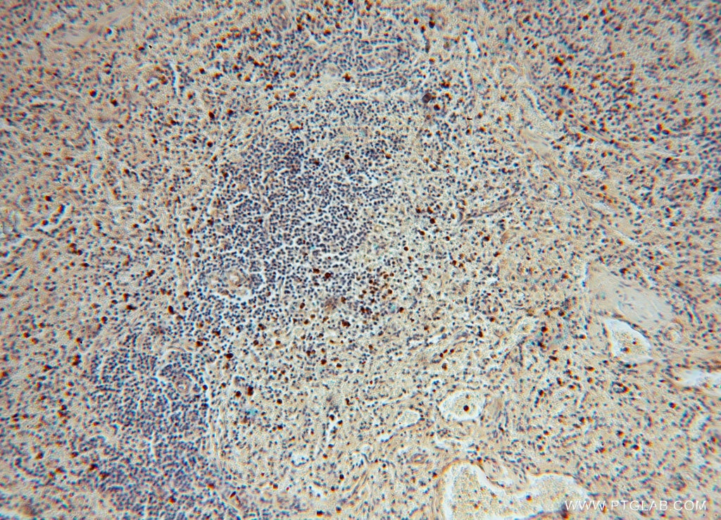 IHC staining of human spleen using 16427-1-AP