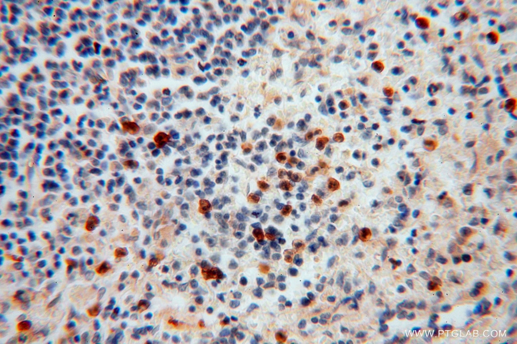 Immunohistochemistry (IHC) staining of human spleen tissue using PAN2 Polyclonal antibody (16427-1-AP)