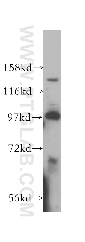 Western Blot (WB) analysis of HepG2 cells using PAN2 Polyclonal antibody (16427-1-AP)