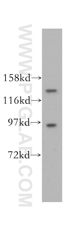 Western Blot (WB) analysis of NIH/3T3 cells using PAN2 Polyclonal antibody (16427-1-AP)