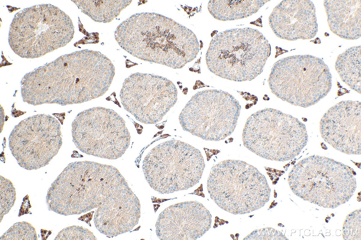 Immunohistochemistry (IHC) staining of mouse testis tissue using PANK1 Polyclonal antibody (11768-1-AP)