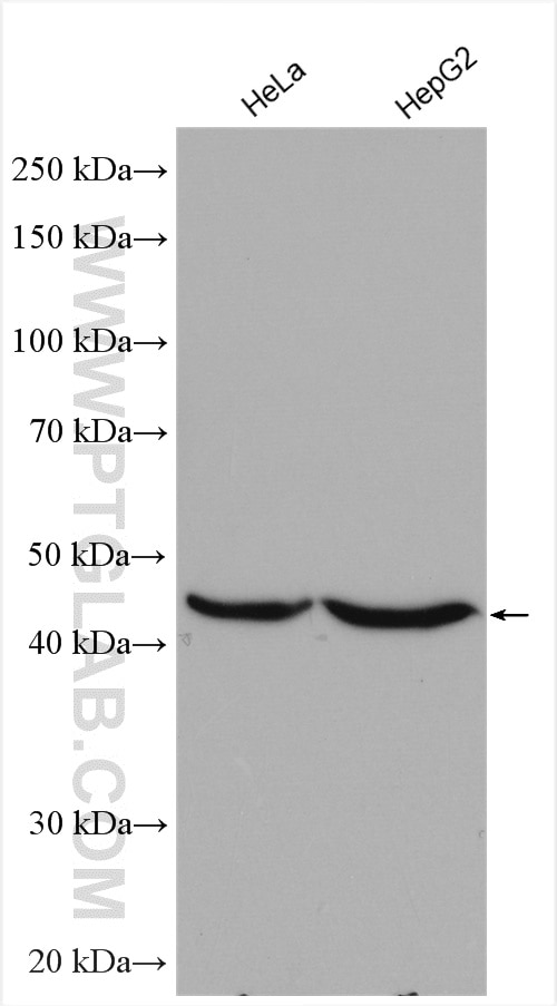 Western Blot (WB) analysis of various lysates using PANK1 Polyclonal antibody (11768-1-AP)