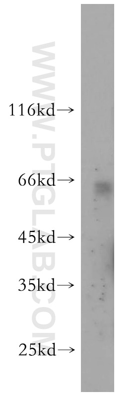 Western Blot (WB) analysis of human heart tissue using PANK1 Polyclonal antibody (11768-1-AP)