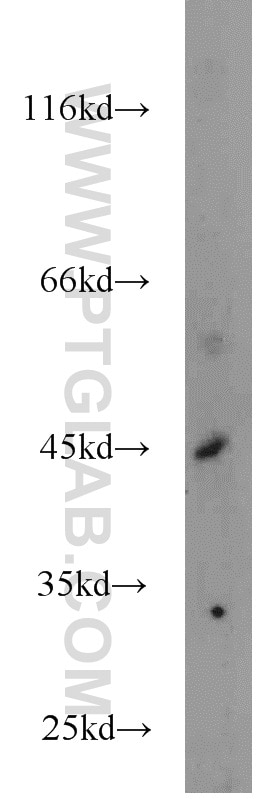 Western Blot (WB) analysis of SW 1990 cells using PANK1 Polyclonal antibody (11768-1-AP)