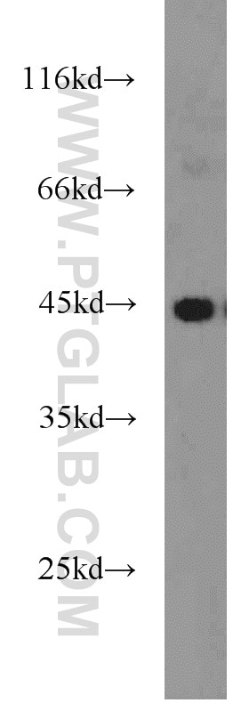 Western Blot (WB) analysis of MCF-7 cells using PANK1 Polyclonal antibody (11768-1-AP)