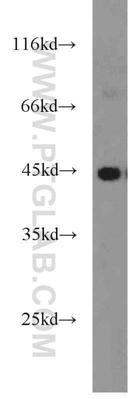 WB analysis of MCF-7 using 11768-1-AP