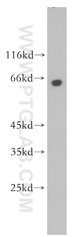 Western Blot (WB) analysis of Raji cells using PANK1 Polyclonal antibody (11768-1-AP)