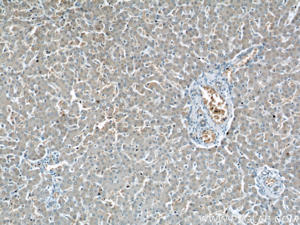 Immunohistochemistry (IHC) staining of human liver tissue using PANK2 Polyclonal antibody (11001-1-AP)