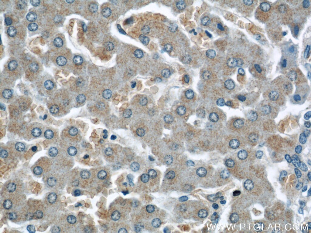 Immunohistochemistry (IHC) staining of human liver tissue using PANK2 Polyclonal antibody (11001-1-AP)