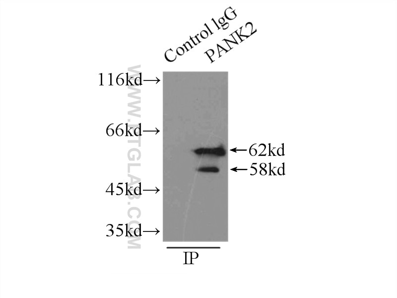 Immunoprecipitation (IP) experiment of mouse brain tissue using PANK2 Polyclonal antibody (11001-1-AP)