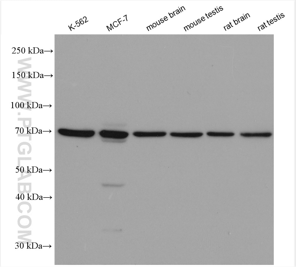 Western Blot (WB) analysis of various lysates using PANK2 Polyclonal antibody (11001-1-AP)